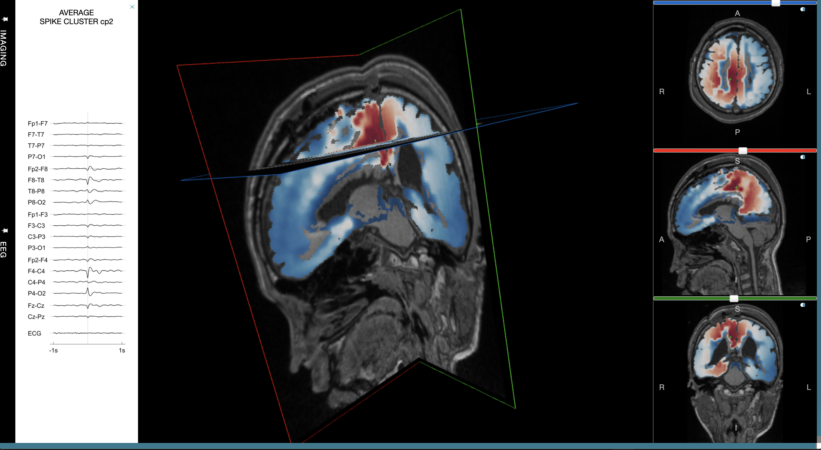 eeg imaging